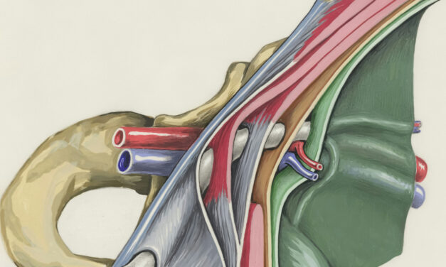 Vein Device Trial Begins Enrolling Dialysis Patients